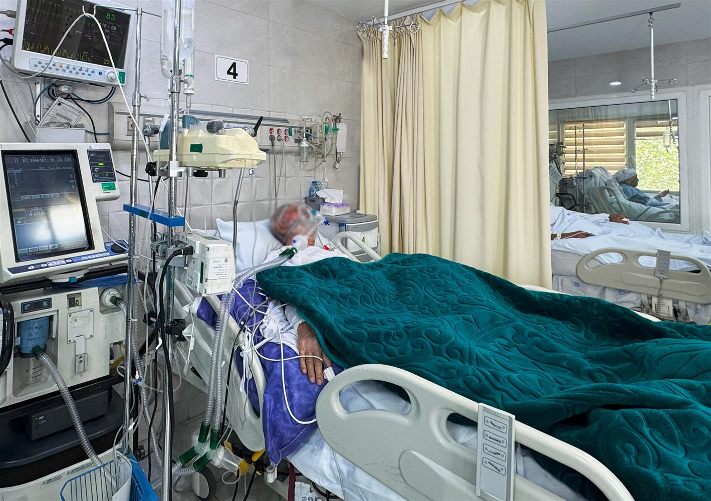 بخش آي سي يو جنرال يك